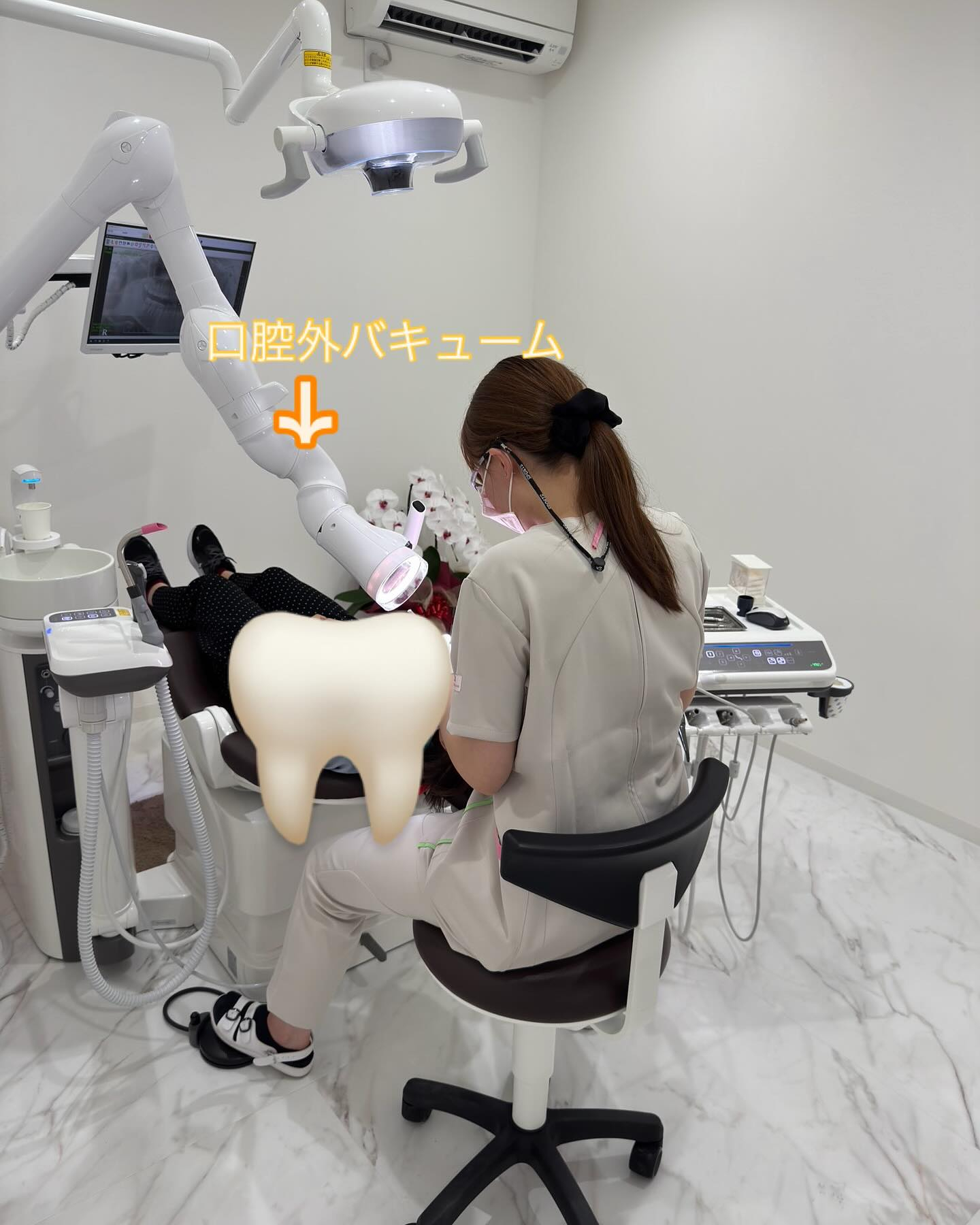 【口腔外バキューム】